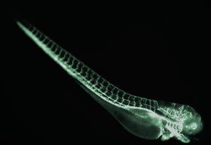 good example of abnormal vasculature gfp