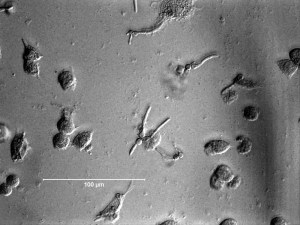WT SC5314 t180 400x scale bar 2